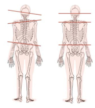 test chiropratico con rappresentazione schematica asimmetrie posturali